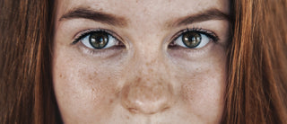 Dark Spots and Pigmentation